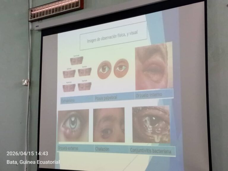 Conferencia sobre la salud visual ofrecida por la ONCIGE en la Facultad de Ciencias de la Salud